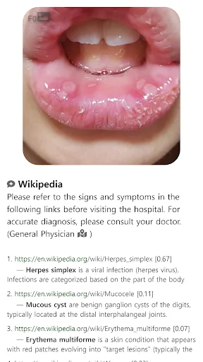 Baixar Model Dermatol – Atlas de Doenças de Pele Grátis - Screenshot 15